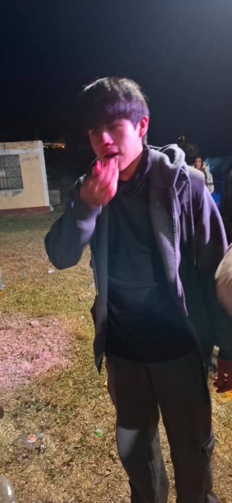 cobarde agresión contra periodista en Carlos Fermín Fitzcarrald- San Luis  